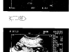 2nd ultrasound (15 weeks)