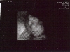 Another shot of Ella\'s face (28 weeks)