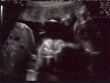 Jack\'s face zoomed in (still need to tilt and squit) (28 weeks)